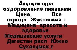 Акупунктура, оздоровление пиявками › Цена ­ 3 000 - Все города, Жуковский г. Медицина, красота и здоровье » Медицинские услуги   . Дагестан респ.,Южно-Сухокумск г.